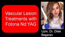 Korumalı: Vascular Lesion Treatments with Fotona Nd:YAG – Uzm. Dr. Dilek Başaran