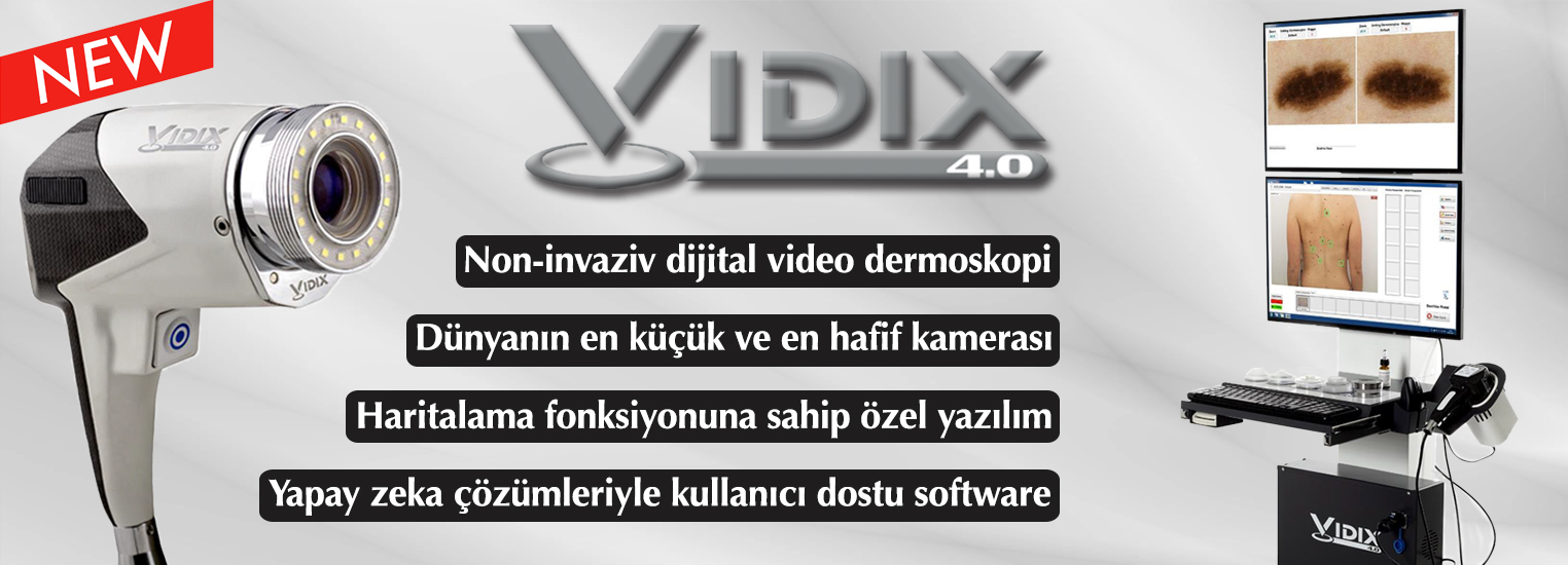 vidix-slider