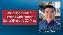 Korumalı: All for Pigmented Lesions with Fotona StarWalker and QX Max – Dr. Lucas Chia